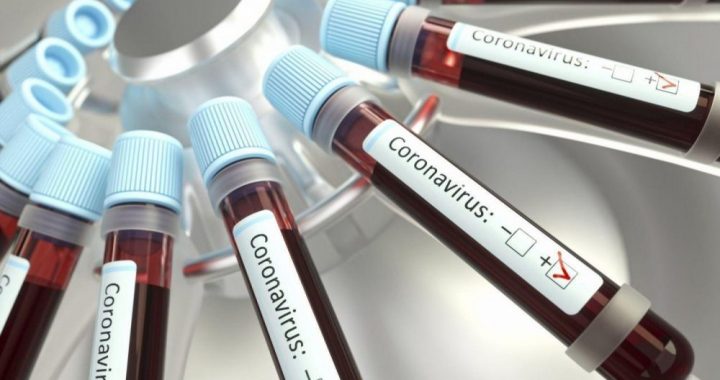 Ўзбекистонда коронавирусга тест топширганлар сони 1 миллиондан ошди